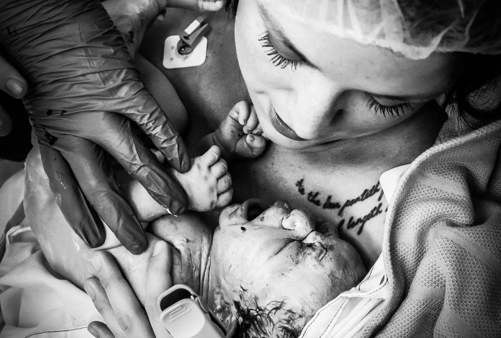 Skin-to-Skin After Caesarean: Why It’s Worth Fighting For